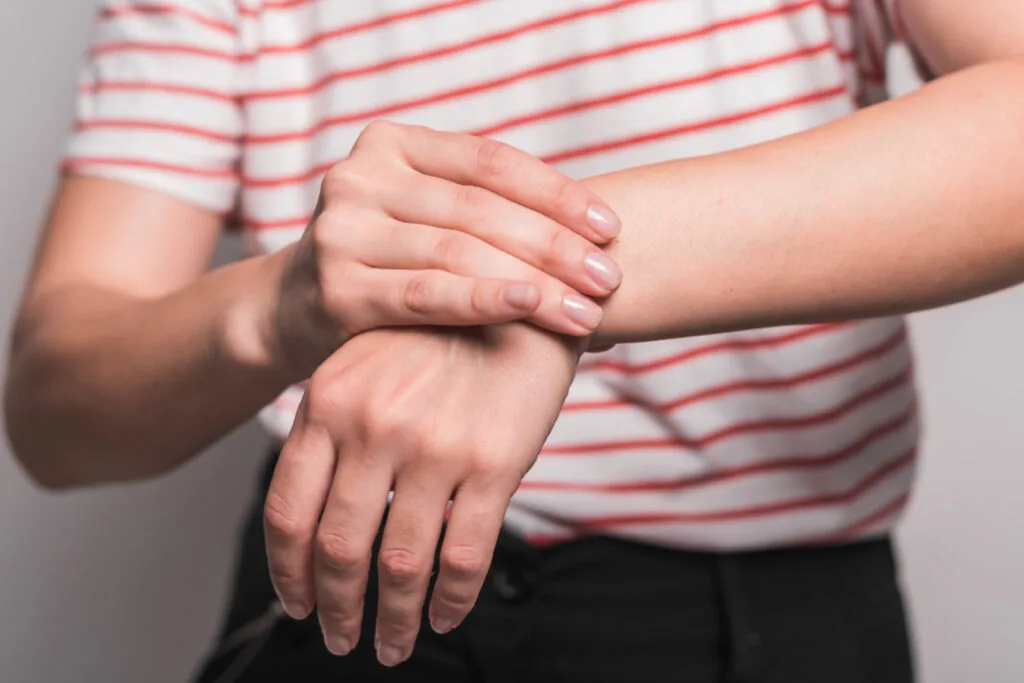 Alergia al látex